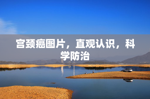 宫颈癌图片，直观认识，科学防治